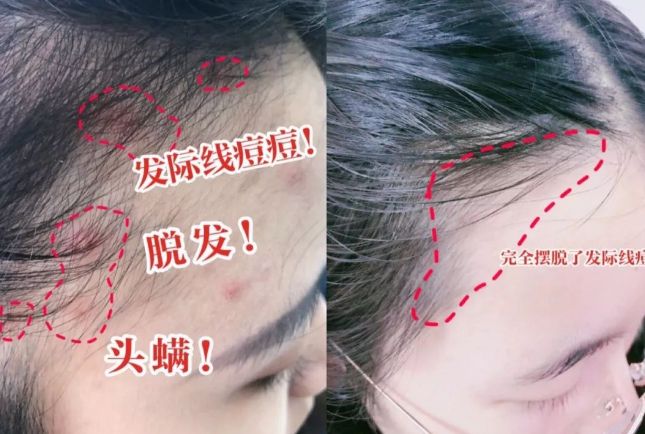 分钟让头发自然干!养出女明星绸缎发!开元棋牌app国产变态“抽水帽”几(图18) 分钟让头发自然干!养出女明星绸缎发!开元棋牌app国产变态“抽水帽”几(图18)